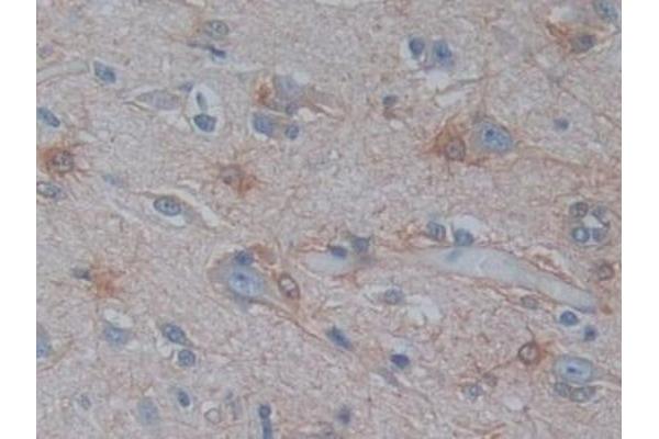 PSAT1 antibody  (AA 1-312)