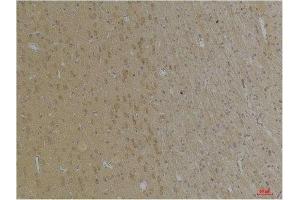 Immunohistochemistry (IHC) analysis of paraffin-embedded Rat Brain Tissue using KCNK4 (TRAAK) Rabbit Polyclonal Antibody diluted at 1:200. (KCNK4 antibody)