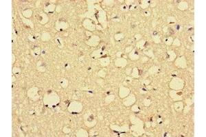 Immunohistochemistry of paraffin-embedded human brain tissue using ABIN7167911 at dilution of 1:100