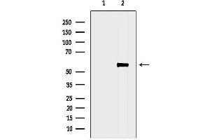 Western blot analysis of lysates from Hybridoma cells, using CS-Specific Antibody.