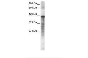 Image no. 2 for anti-Proteasome (Prosome, Macropain) 26S Subunit, ATPase, 3 (PSMC3) (AA 293-339) antibody (ABIN202439) (PSMC3 antibody  (AA 293-339))