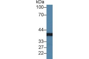 Detection of CHRDL1 in Rat Kidney lysate using Polyclonal Antibody to Chordin Like Protein 1 (CHRDL1) (CHRDL1 antibody  (AA 272-447))