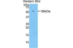 Western Blotting (WB) image for anti-P-Cadherin (CDH3) (AA 565-822) antibody (ABIN1858339)