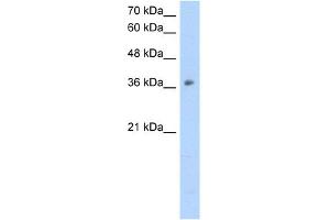 WB Suggested Anti-OTC Antibody Titration:  2.