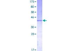 Colony Stimulating Factor 2 (Granulocyte-Macrophage) (CSF2) (AA 1-144) protein (GST tag)
