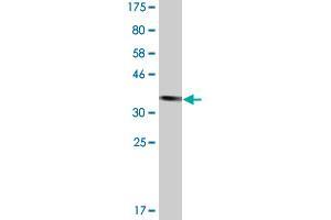 Western Blot detection against Immunogen (39. (TTF2 antibody  (AA 385-509))