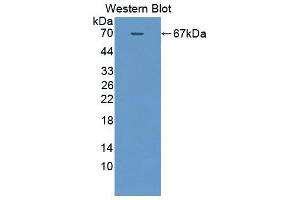 Western blot analysis of the recombinant protein. (SMPD2 antibody  (AA 1-324))