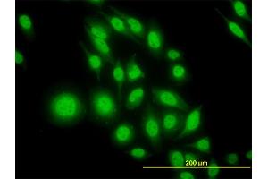 Immunofluorescence of monoclonal antibody to ATF4 on HeLa cell. (ATF4 antibody  (AA 171-270))