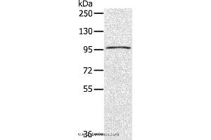 Western blot analysis of A549 cell, using CIZ1 Polyclonal Antibody at dilution of 1:200 (CIZ1 antibody)