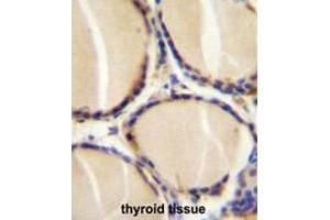 CALCA Antibody (Center) immunohistochemistry analysis in formalin fixed and paraffin embedded human thyroid tissue followed by peroxidase conjugation of the secondary antibody and DAB staining. (CGRP antibody  (Middle Region))