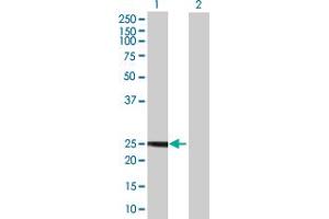 Western Blot analysis of MYL4 expression in transfected 293T cell line by MYL4 MaxPab polyclonal antibody. (MYL4 antibody  (AA 1-197))