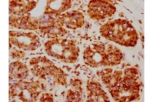 IHC image of nforHU diluted at 1:20 and staining in paraffin-embedded human breast cancer performed on a Leica BondTM system. (Histone H2B antibody  (AA 2-13))