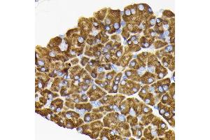 Immunohistochemistry (IHC) image for anti-Ribosomal Protein S3 (RPS3) (AA 1-243) antibody (ABIN3023343)