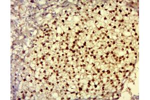 Paraformaldehyde-fixed, paraffin embedded mouse placenta tissue; Antigen retrieval by boiling in sodium citrate buffer (pH6.