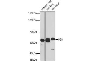 Western blot analysis of extracts of various cell lines, using FGB antibody (ABIN3021949, ABIN3021950, ABIN3021951 and ABIN6218213) at 1:1000 dilution. (Fibrinogen beta Chain antibody  (AA 202-491))