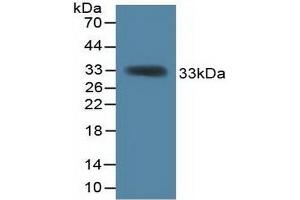 Detection of Recombinant KHDRBS1, Mouse using Polyclonal Antibody to KH Domain Containing, RNA Binding, Signal Transduction Associated Protein 1 (KHDRBS1) (KHDRBS1 antibody  (AA 156-381))