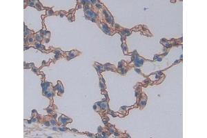Used in DAB staining on fromalin fixed paraffin- embedded lung tissue (ABCA8 antibody  (AA 1305-1516))