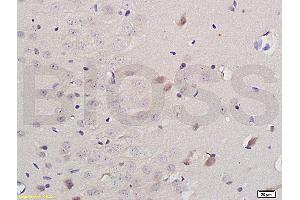 Formalin-fixed and paraffin embedded: rat brain tissue labeled with Anti-iNOS Polyclonal Antibody (ABIN725675) , Unconjugated at 1:200 followed by conjugation to the secondary antibody and DAB staining (NOS2 antibody)