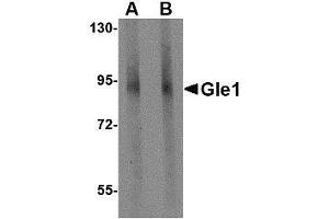 Western blot analysis of Gle1 in mouse brain tissue lysate with AP30366PU-N Gle1 antibody at (A) 1 and (B) 2 μg/ml. (GLE1 antibody  (C-Term))