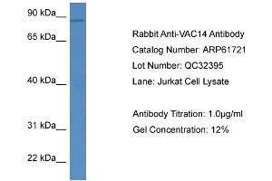Western Blotting (WB) image for anti-Vac14 Homolog (VAC14) (C-Term) antibody (ABIN2788881) (VAC14 antibody  (C-Term))