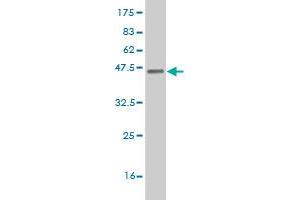 Western Blot detection against Immunogen (37. (ETV5 antibody  (AA 181-290))