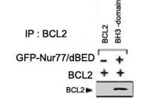 Analysis of BCL2 domain exposure in HEK293 cells transfected with a plasmid coding for a DNA-binding domain-deleted construct of Nur77 (GFP-Nur77/dDBD) by using BCL2 polyclonal antibody  for immunoprecipitation (IP) and a different BCL2 antibody for western blot. (Bcl-2 antibody)