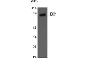 Western Blotting (WB) image for anti-MYST Histone Acetyltransferase 2 (MYST2) antibody (ABIN5956839) (MYST2 antibody)