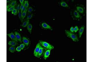 RYR1 antibody  (AA 1-534)