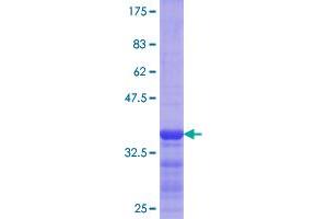 Flotillin 1 Protein (FLOT1) (AA 126-225) (GST tag)