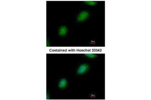 ICC/IF Image Immunofluorescence analysis of paraformaldehyde-fixed HeLa, using TPRKB, antibody at 1:500 dilution. (TPRKB antibody)