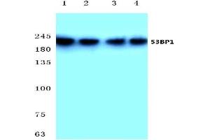 Western blot analysis of 53BP1 antibody at 1/500 dilution: Lane 1: Hela cell lysate. (TP53BP1 antibody)