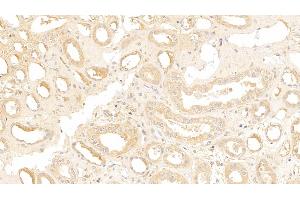 Detection of IGSF1 in Human Kidney Tissue using Polyclonal Antibody to Immunoglobulin superfamily, member 1 (IGSF1) (IGSF1 antibody  (AA 1008-1227))