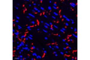 Immunofluorescence of paraffin embedded mouse heart using THNSL2 (ABIN7075893) at dilution of 1: 400 (400x lens) (THNSL2 antibody)