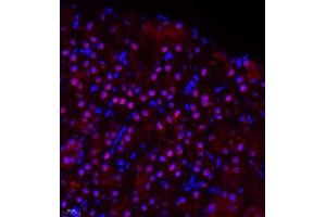 Immunofluorescence of paraffin embedded rat kidney using ZHX3 (ABIN7076287) at dilution of 1:650 (400x lens)