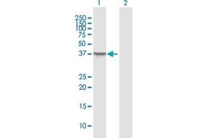 Western Blotting (WB) image for anti-Oxidase (Cytochrome C) Assembly 1-Like (OXA1L) (AA 1-435) antibody (ABIN948212)