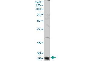 UBE2B MaxPab polyclonal antibody. (UBE2B antibody  (AA 1-152))