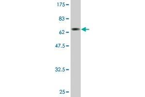 Western Blot detection against Immunogen (69. (ACAT2 antibody  (AA 1-397))