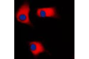 Immunofluorescent analysis of CK1 gamma 2 staining in Raw264. (Casein Kinase 1 gamma 2 antibody  (N-Term))