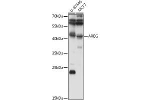 Western blot analysis of extracts of various cell lines, using AREG antibody (ABIN6127431, ABIN6137065, ABIN6137066 and ABIN6216408) at 1:1000 dilution.