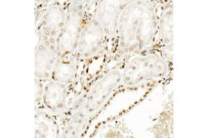 Immunohistochemistry of paraffin-embedded rat kidney using Phospho-POLR2A CTD-S5 Rabbit mAb  at dilution of 1:200 (40x lens). (POLR2A/RPB1 antibody  (pSer5))