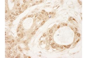 Immunohistochemistry (IHC) image for anti-Chromosome 1 Open Reading Frame 55 (C1orf55) (AA 350-400) antibody (ABIN7448452) (C1orf55 antibody  (AA 350-400))
