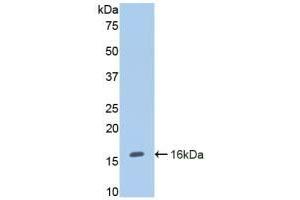 Detection of Recombinant ENG, Human using Polyclonal Antibody to Endoglin (ENG) (Endoglin antibody  (AA 26-136))