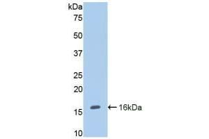 Endoglin 抗体  (AA 26-136)