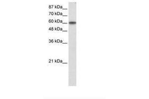 Image no. 1 for anti-Kruppel-Like Factor 11 (KLF11) (AA 61-110) antibody (ABIN203187) (KLF11 antibody  (AA 61-110))
