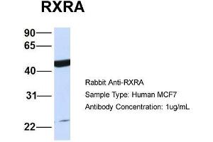 Host:  Rabbit  Target Name:  RXRA  Sample Type:  Human MCF7  Antibody Dilution:  1. (Retinoid X Receptor alpha antibody  (N-Term))