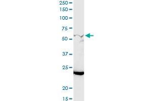 GALNT12 MaxPab rabbit polyclonal antibody. (GALNT12 antibody  (AA 1-272))
