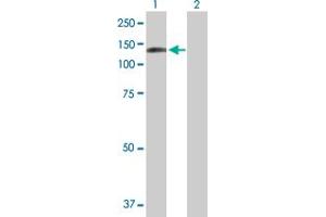 Western Blot analysis of DDX24 expression in transfected 293T cell line by DDX24 MaxPab polyclonal antibody. (DDX24 antibody  (AA 1-804))