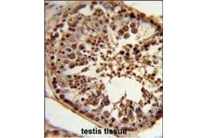 Formalin-fixed and paraffin-embedded human testis tissue reacted with CS Antibody (N-term), which was peroxidase-conjugated to the secondary antibody, followed by DAB staining. (CSPP1 antibody  (N-Term))