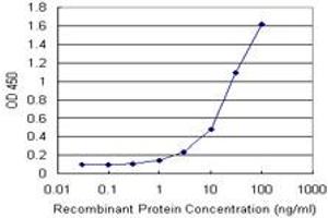 Detection limit for recombinant GST tagged FTL is 1 ng/ml as a capture antibody. (FTL antibody)