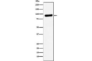 Western blot analysis of RRM1 expression in A549 cell lysate.